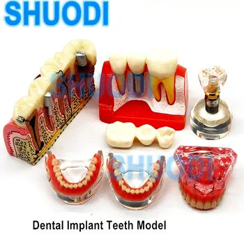 1 шт Демонстрационная модель зубного имплантата Изучение зубов Обучающая модель Общение Зубной протез Внутренняя модель нижней челюсти